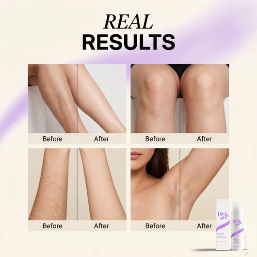 Painless Hair Removal Mousse That Actually Smells Good